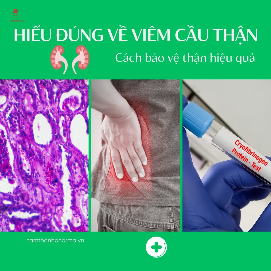 viem-cau-than