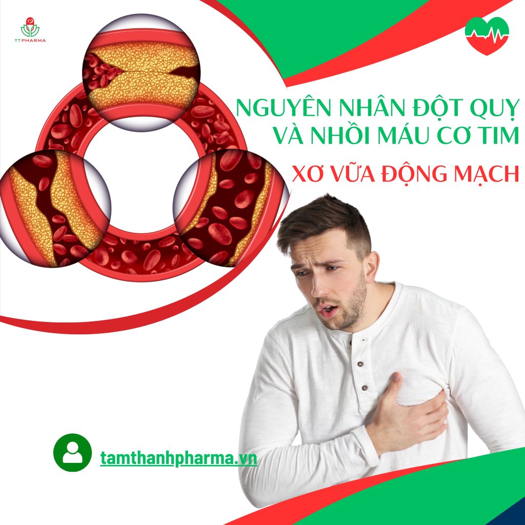 xo-vua-dong-mach
